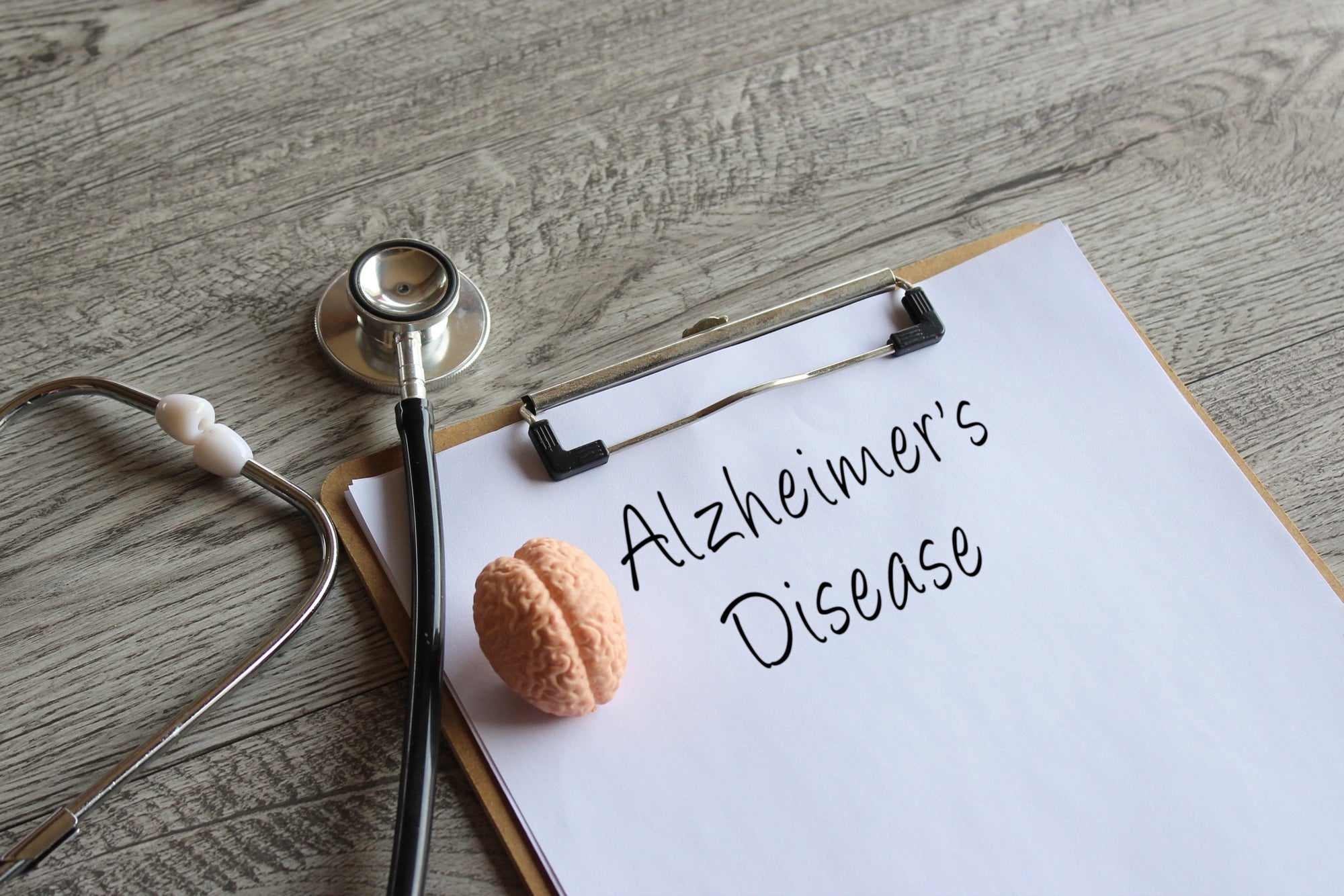 Caring For Elderly Alzheimer's Patients: A Guide